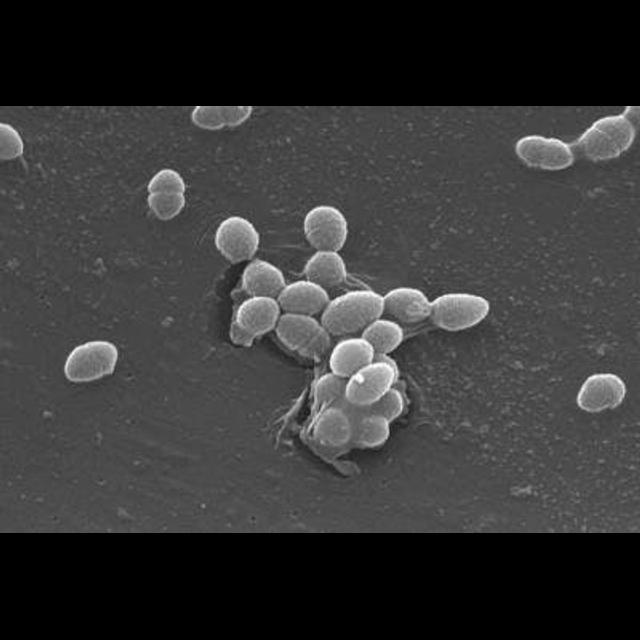 U.S. Immigrants Leave Country&mdash;and Microbes&mdash;Behind - podcast episode cover