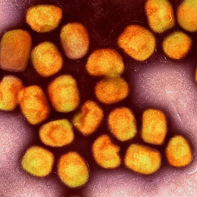 What is Monkeypox? With Dr. Anne Rimoin - podcast episode cover
