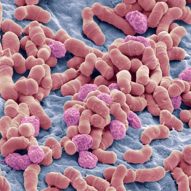 Rain Forest Dwellers and Urbanites Have Consistently Different Microbiomes - podcast episode cover