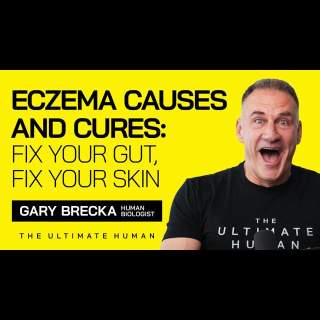 176. Why Your Eczema Isn’t Just Skin Deep...Here’s the REAL Cause! - podcast episode cover