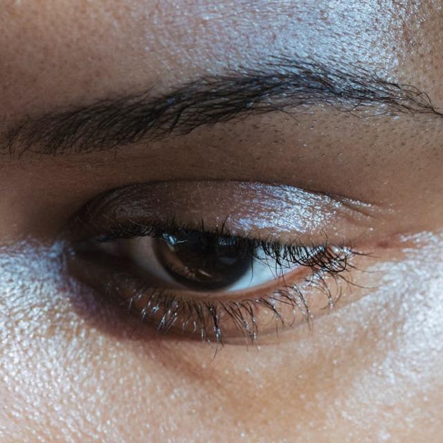 611: Dark Under Eyes: How Do We Treat Them? - podcast episode cover