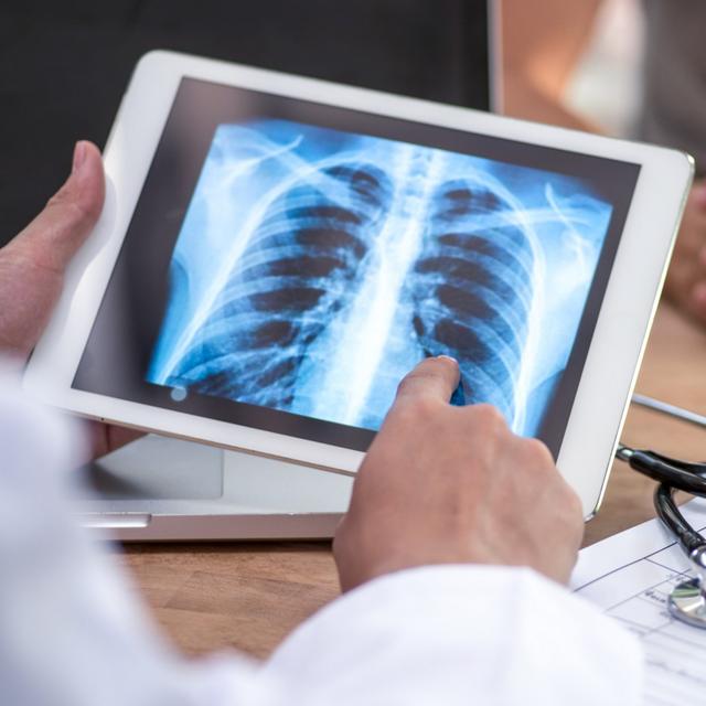 Artificial intelligence helps doctors detect lung cancer - podcast episode cover