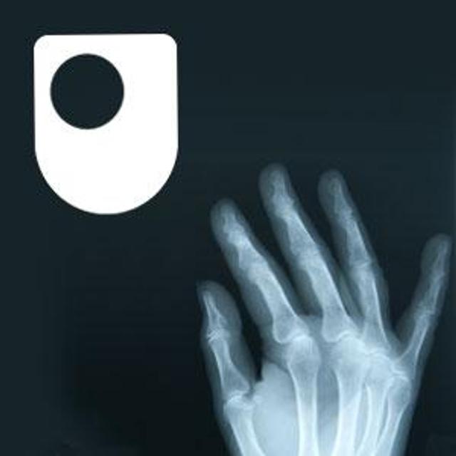 Rheumatoid arthritis - a long term condition - for iPad/Mac/PC - podcast cover